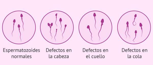 Druhy spermií - Druhy spermií podle jejich morfologie