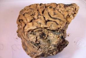 Мозок Геслінгтона: характеристики цієї історичної аномалії