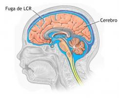 Cerebrospinalinis skystis (CSF): sudėtis ir funkcijos