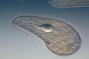 Verschil tussen eukaryote en prokaryote cel