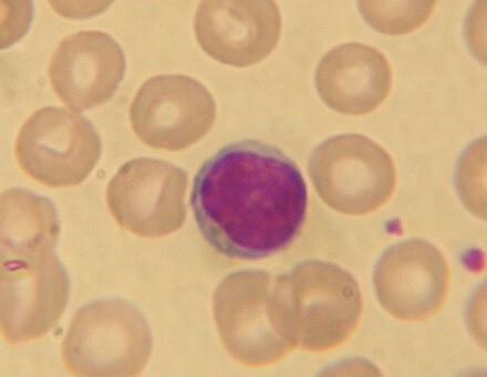 Лимфоцит