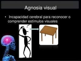 Vizuālā agnozija: nespēja saprast vizuālos stimulus
