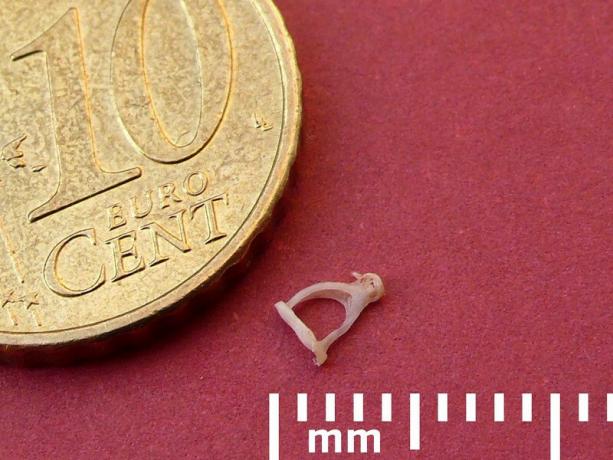 Smallest bone in the human body