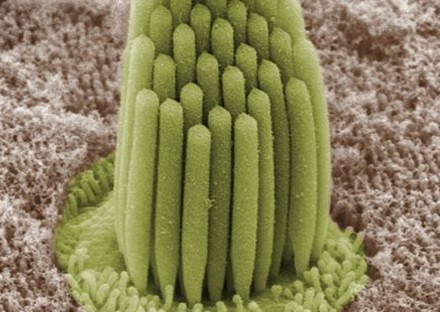 Cilia of the auditory system