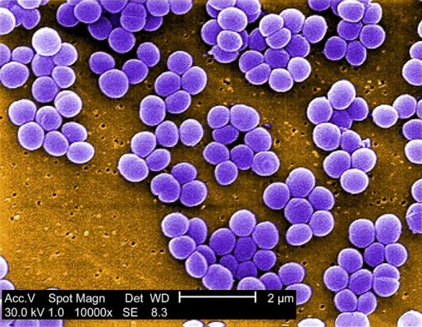 Typy prokaryotických buněk Staphylococcus aureus