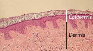 Funktionerna i huden och dess lager - Dermis 