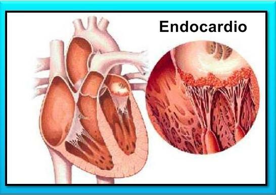 Hjärtlager - Endokardium, ett av hjärtskikten 