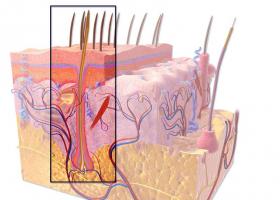 Alopecia nervosa: sintomas, causas e tratamento