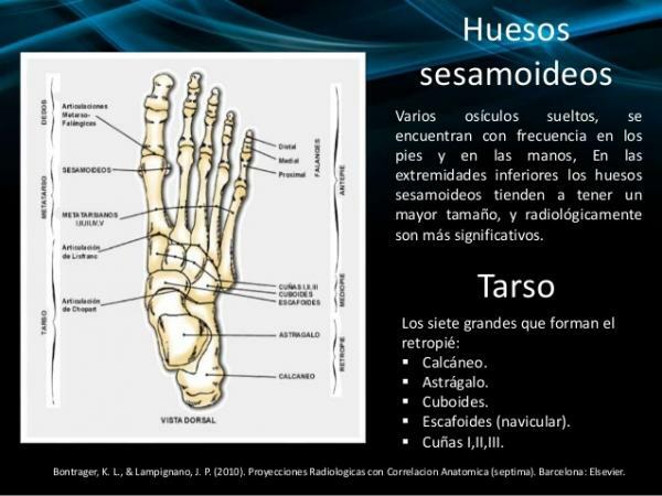 Co jsou sezamoidní kosti - sezamoidní kosti nohy