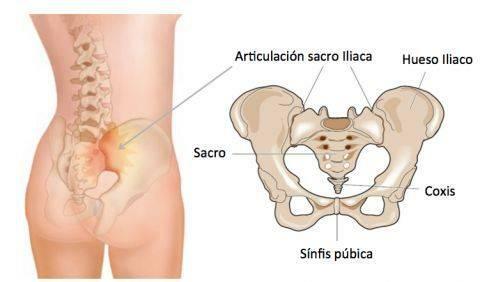 척추 부분 - 천골 부위