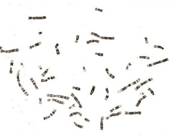 ľudské chromozómy