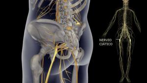 Ischiatický (sedací) nerv: anatómia, funkcie a patológie