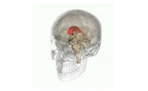 脳梁離断術：それは何ですか、フェーズ、有用性および関連するリスク