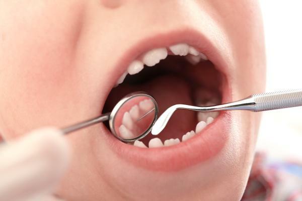 Dantų klasifikacija – Pieniniai dantys